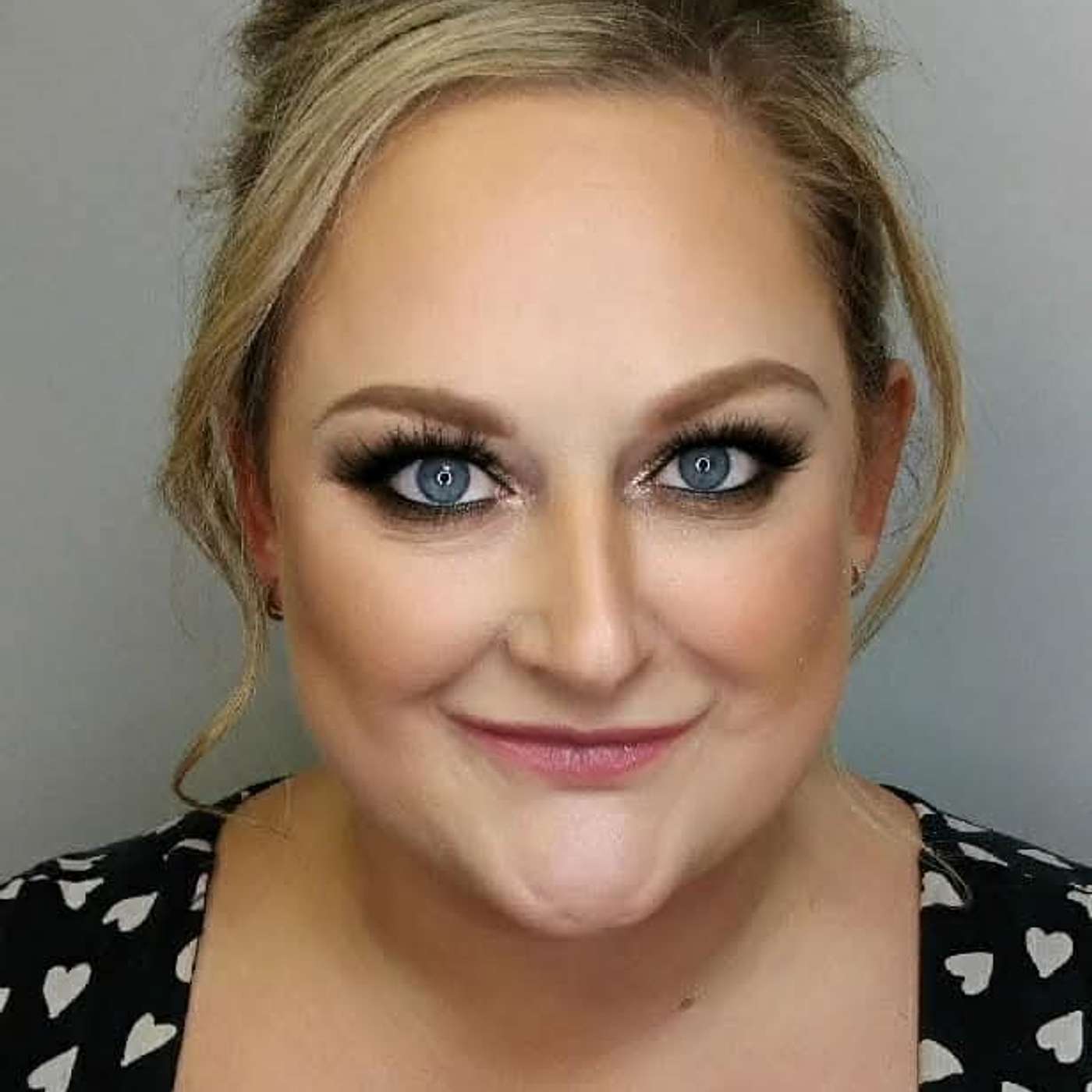 Terri Quigley: Lived experience, severe asthma, and why digital tools can save lives